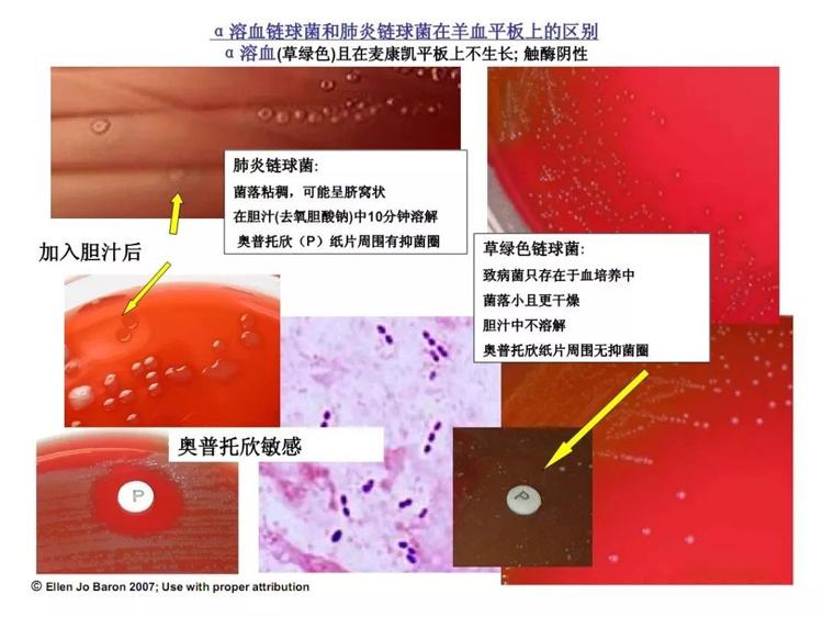 α溶血链球菌和肺炎链球菌在羊血平板上的区别