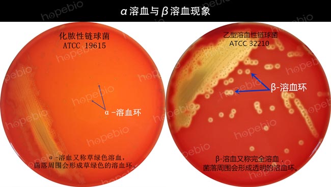 溶血特征