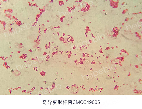 革兰氏染色镜检图——奇异变形杆菌