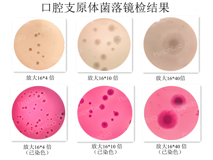 口腔支原体菌落镜检结果