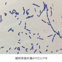 革兰氏染色镜检图——蜡样芽孢杆菌/
