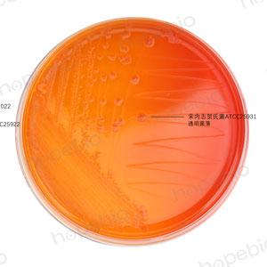 MAC-福氏志贺氏菌、大肠埃希氏菌、宋内志贺氏菌、痢疾志贺氏菌/